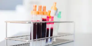 Reagenzgläser mit Blut